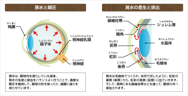 緑内障の原因