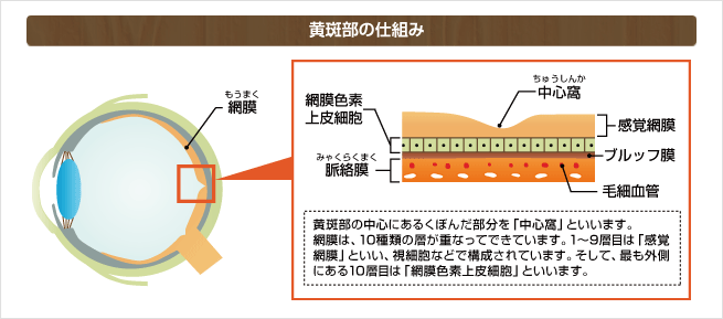 加齢黄斑変性の原因